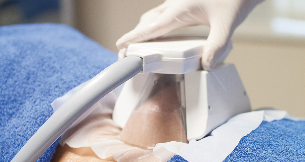 How Fat Freezing and HIFU Work Together? 2 Multiple Areas in One Session HIFU and Fat Freezing Birch