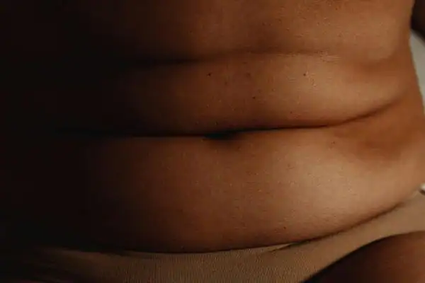 The Hidden Connection: How Stress Shapes Your Fitness and Body Composition 3 image of what stress can do on the stomach area and how Lipo 360 Birch can help to change your body shape.